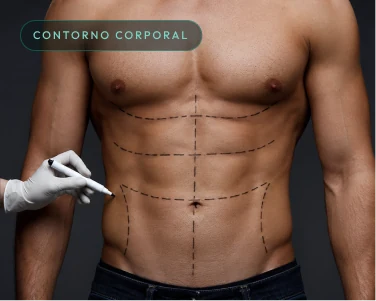 Lipoaspiração masculina — abdômen definido